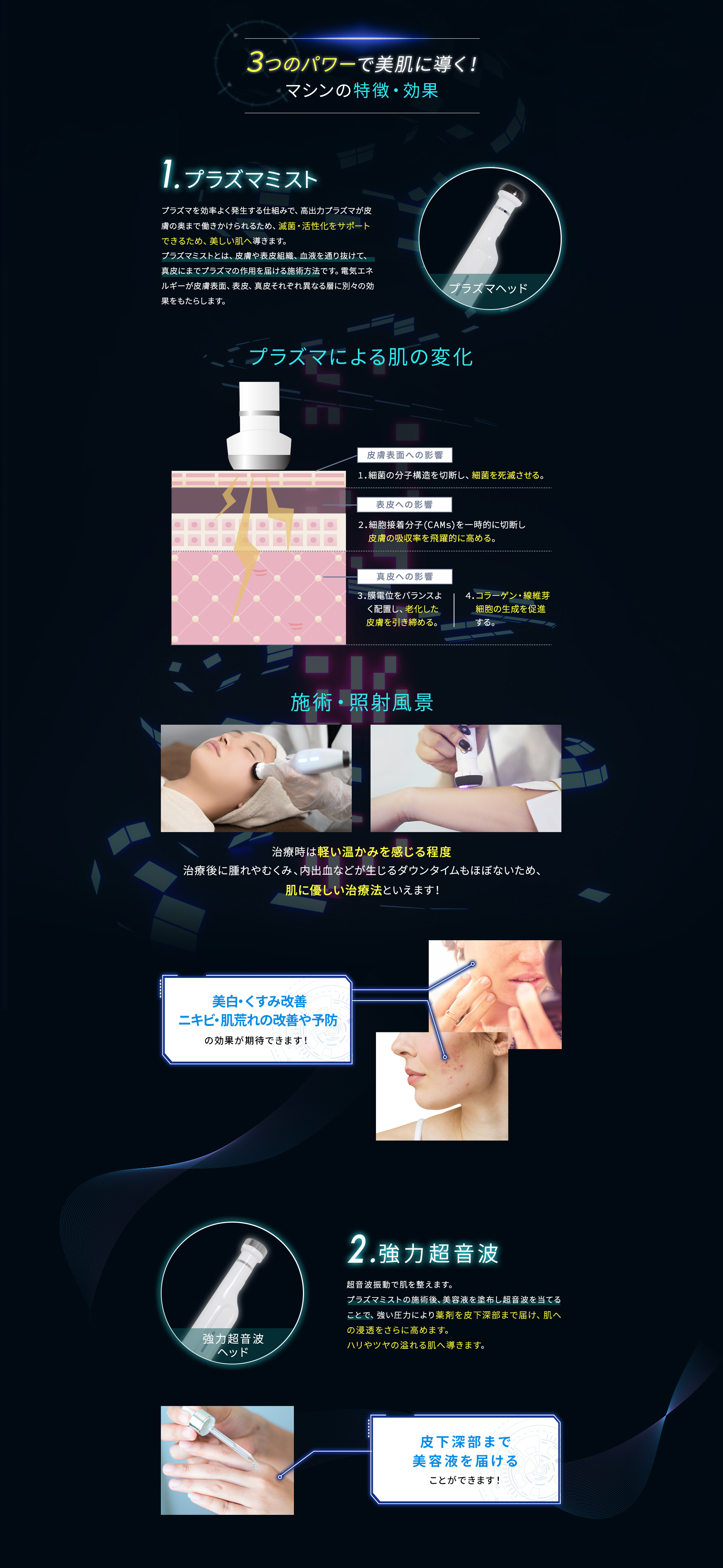 シミプラズマ マシンの特徴