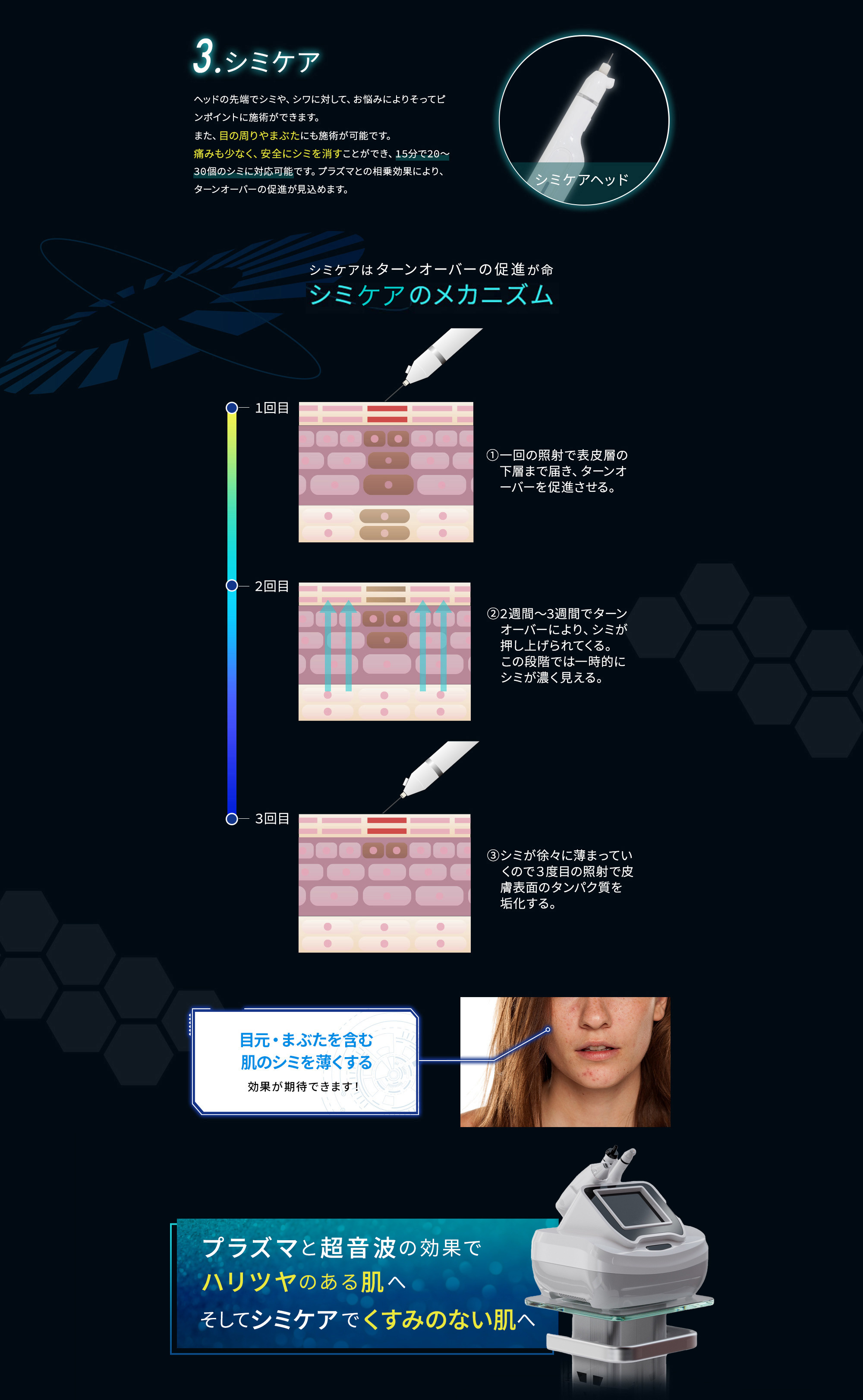 シミプラズマ マシンの特徴