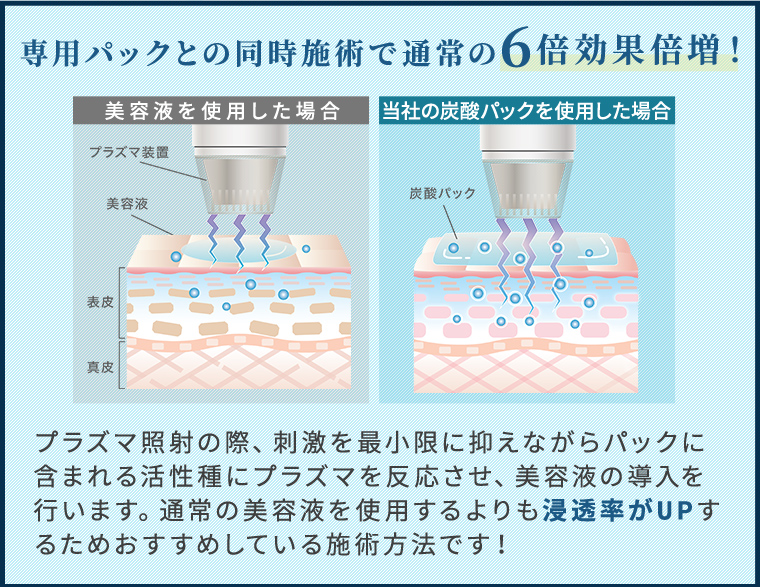 シミプラズマネオ×炭酸パック